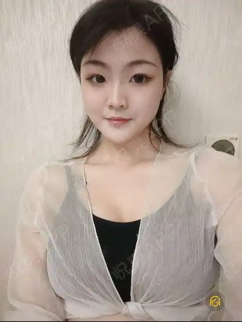 乳房下垂矫正术后124天_胸型美化术后124天_胸部整形术后124天_悦mer