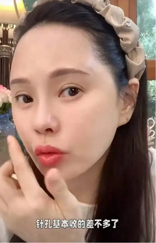 秦昊老婆跑韩国打水光针56岁伊能静满脸针眼感慨真的很痛