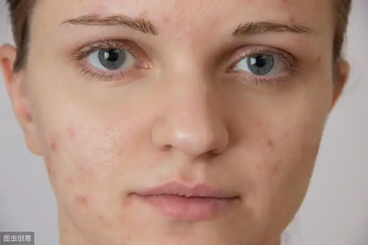 为什么总是肤色暗沉?肤色暗沉如何改善,可多吃八种食物_皮肤