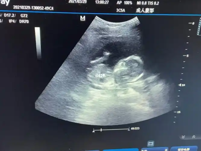 翻到了四个月时候宝宝在妈妈肚子里的样子