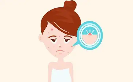 春季满脸长痤疮能治痤疮的潍坊皮肤科注意皮肤保湿