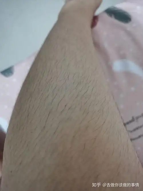 女生汗毛重是怎样的一种体验