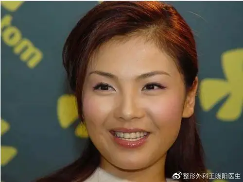 刘涛的"颧骨高",为何成不了高级脸?