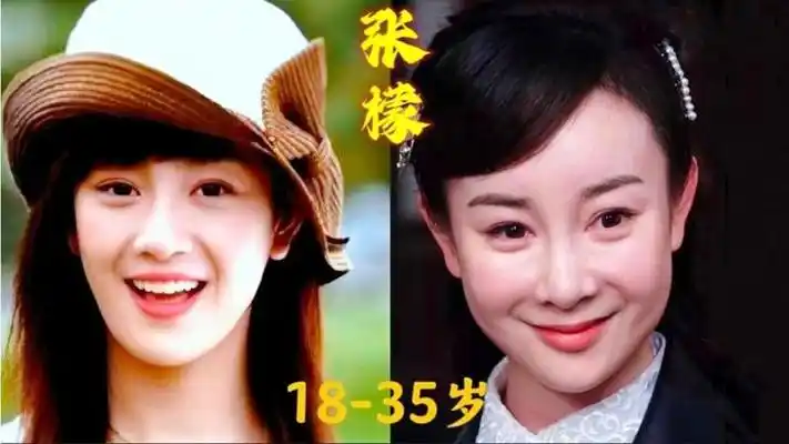 "张檬"18到35岁的变化,为爱整容葬送了整个演艺生命