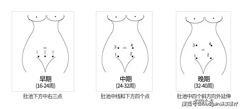 如何找准胎心位置?