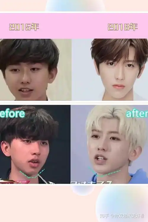 这张脸太假了蔡徐坤为什么总是被说整容