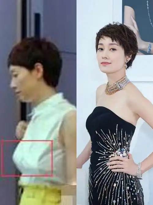 饱满挺拔的胸部是女性的自信和魅力所在,所以绝对不能允许乳房下垂!