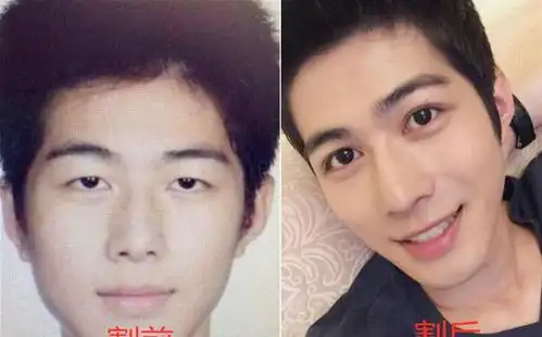 原创明星割双眼皮前后大对比,陈学冬堪比整容,他割了之后成巨星