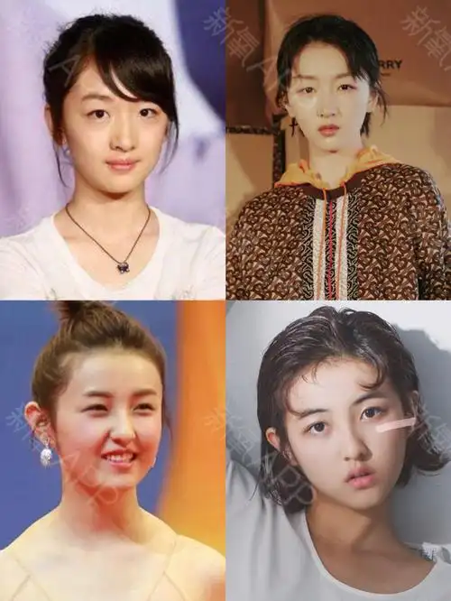 仅仅靠"少年感"风格真的能出彩吗?张_圈子-新氧美容整形