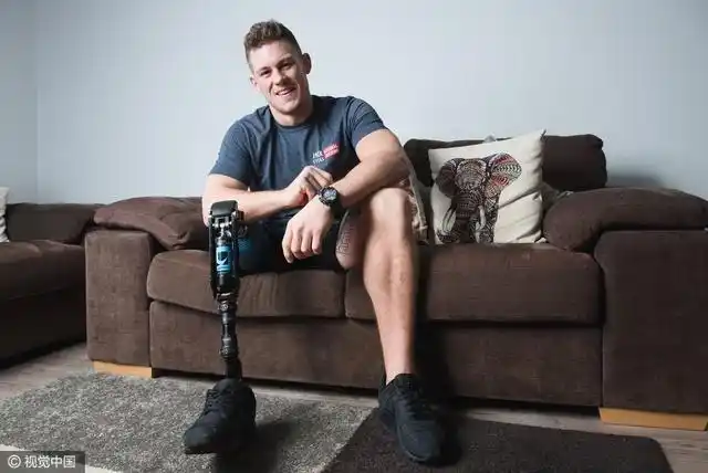 英国截肢帅哥成纽约残疾模特"第一人"