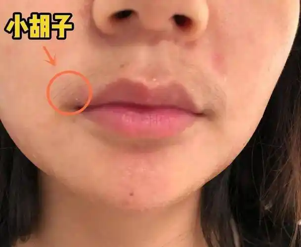 接吻时最让男生恶心的3种行为90的女生都做过自己却不知道