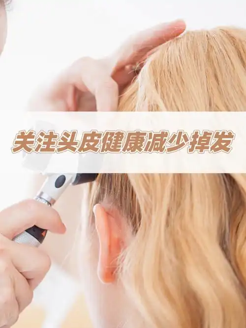 02关注头皮健康减少掉发