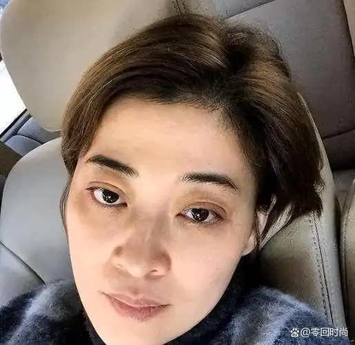 明星素颜真容与普通人的皮肤区别并不大?让我们来一探究竟