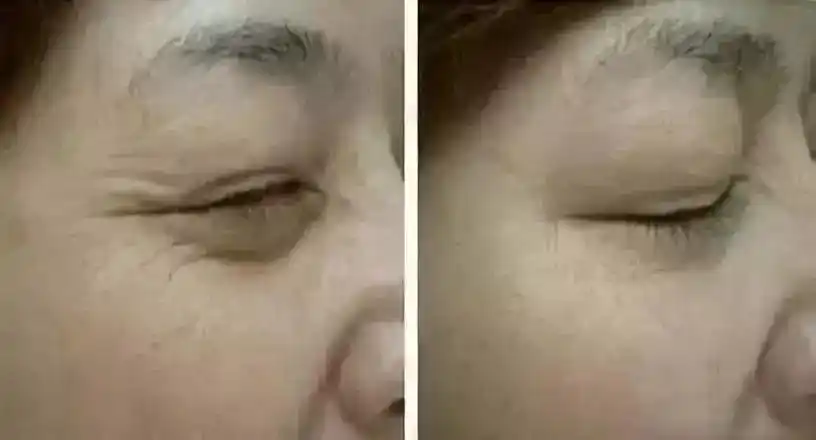 用它抹一抹,细纹眼袋,黑眼圈60秒消失!去美容院的钱都省了!