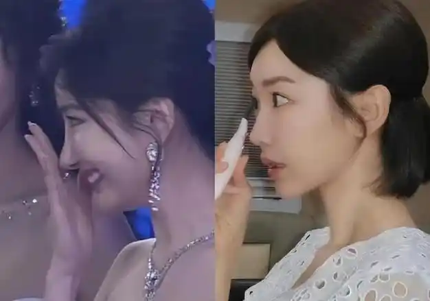 36岁毛晓彤近照来袭疑似整容后遗症明显鼻子好像都不一样了