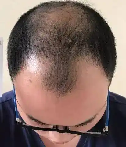 现在想了想会说是头发和额头