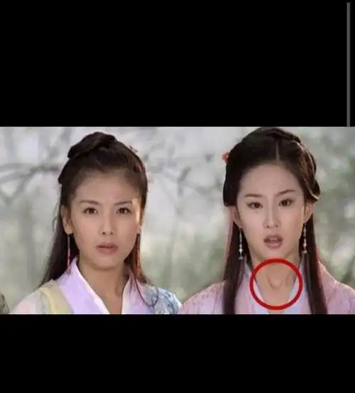 其次,刘亦菲在出演《天龙八部》时出现了喉结,这很明显是男人的特征.