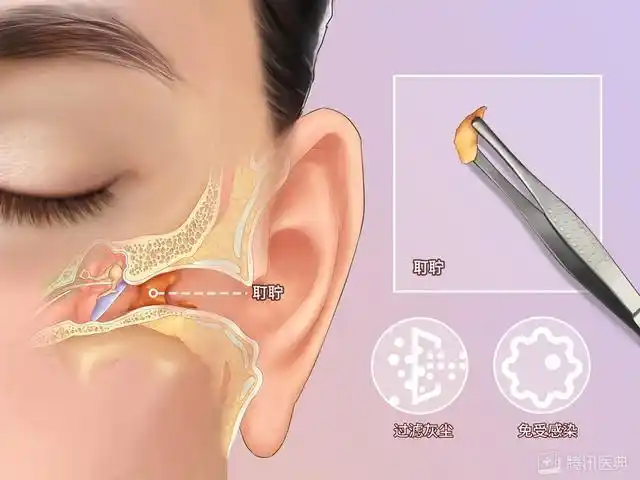 有一种爽叫掏耳朵,掏耳朵为什么爽?