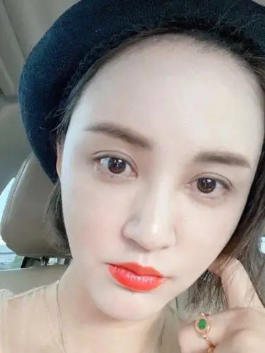 从张歆艺的面部近照来看,即使是减掉快20斤,她的脸还是存在不自然