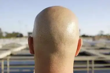 光头男拒不承认吸毒警察没法用头发检测改用这个