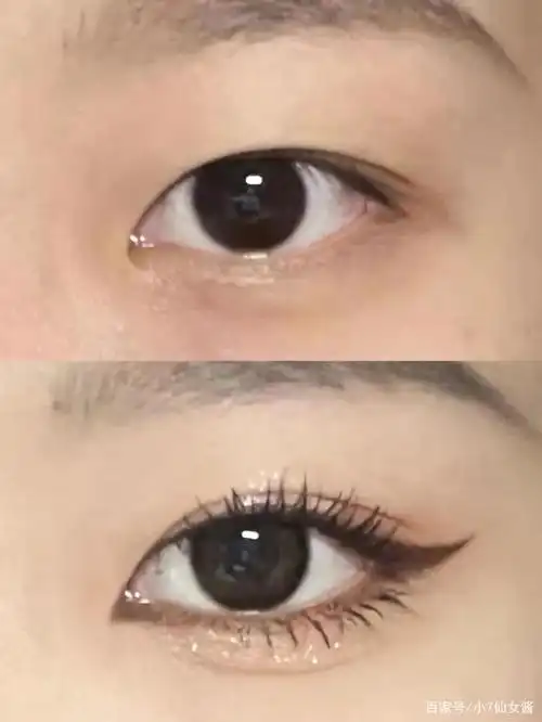 会先在下眼睑眼