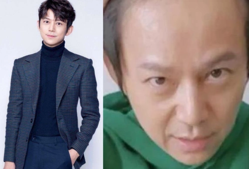 有种"反差"叫明星掀刘海,杨幂被要求植发,看到何炅:不敢相信