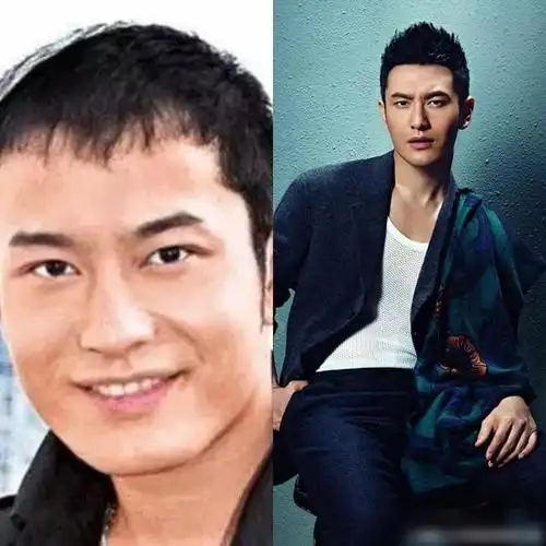 以前的黄晓明发际线很高,而且是单眼皮,很宽的腮帮子,双下巴,鼻梁也没