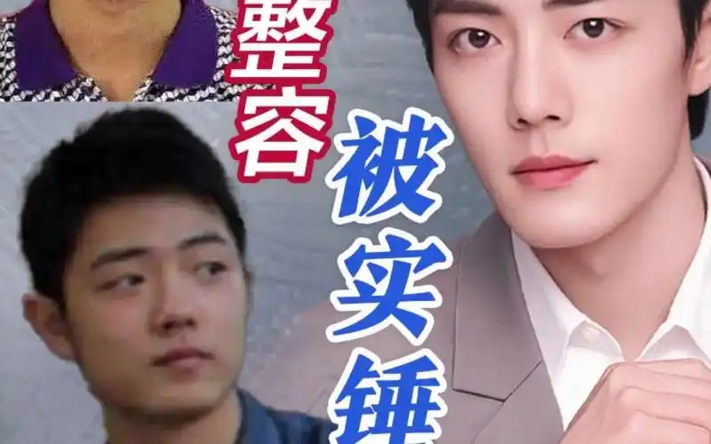 肖战整容被实锤? - 视频下载 video downloader