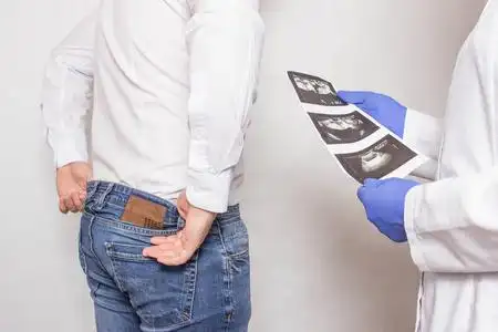 前列腺检查泌尿科医生拿着一张病人前列腺超声检查的照片,准备进行