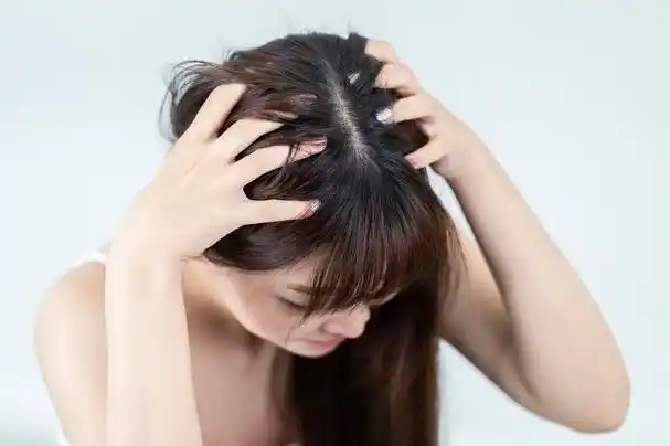 头油头皮痒用什么方法好(六个小妙招告别头油头痒)(1)