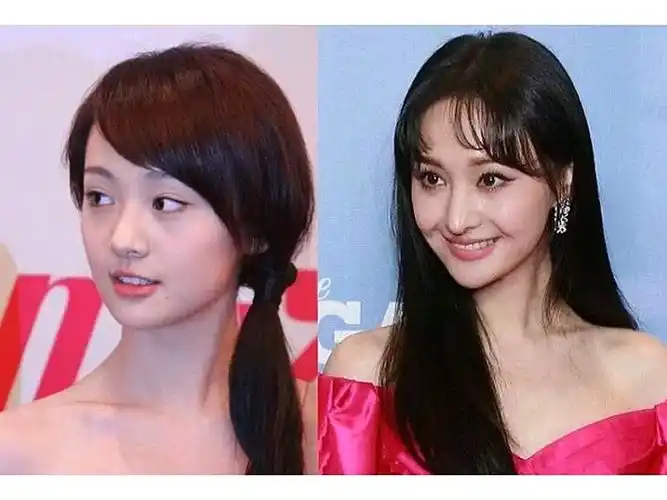 心疼郑爽,因为鼻子毁了一张脸.真的挺心疼爽妹儿的.