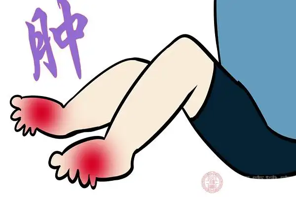 在运动时不慎将脚扭伤了,脚部会出现剧烈的疼痛感,这时最好停下来不要