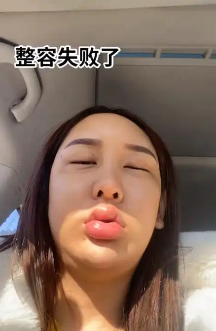 嘟嘟唇搞笑图片