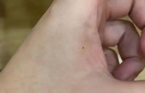 【虎口有痣的女人】女人左手虎口有痣:说明她是个很厉害的人,如果她的