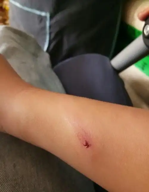 的伤情照片显示,胳膊上,腿上多处破损,有明显的被数据线抽打过的痕迹