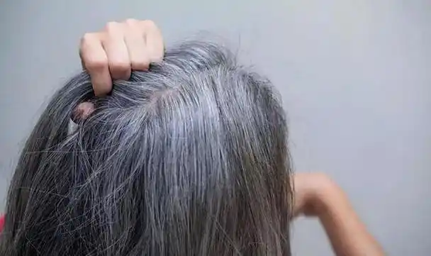 女性头顶长白发吃什么(女性头上白发增多)(3)