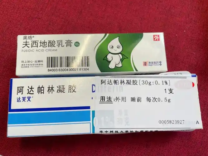 治痘痘|三甲医院皮肤科门诊开的药