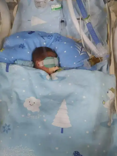 480克胎龄24周1天佛山成功救治超早早产儿再刷新纪录