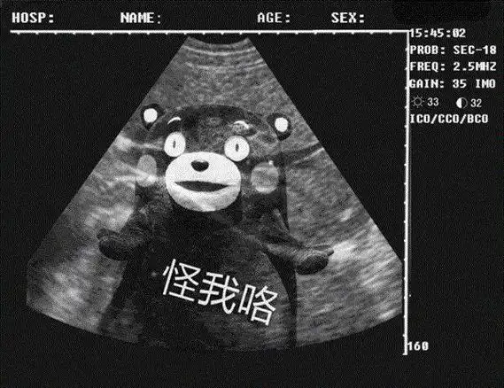 抖音我怀孕了给你看b超表情包大全抖音我怀孕了恶搞套路表情包