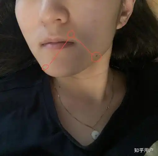 脸上长了北斗七星痣,有什么寓意嘛?