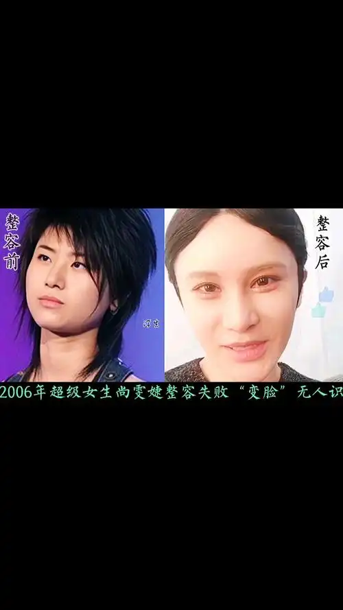 超级女声冠军尚雯婕整容前后判若两人