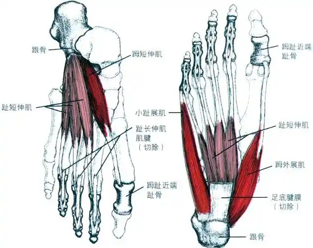 激痛点疗法小趾外展肌