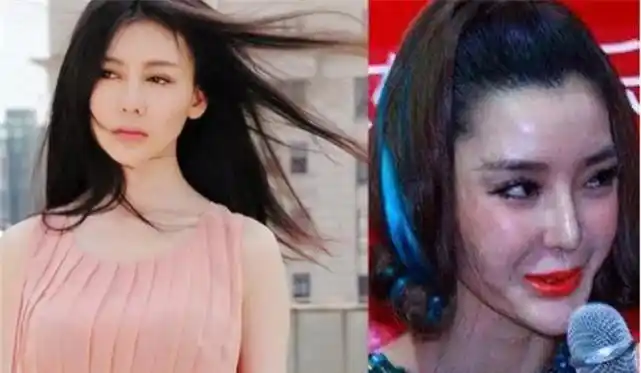 整容后遗症太可怕李小璐五官塌陷最后一位都能吓跑小偷