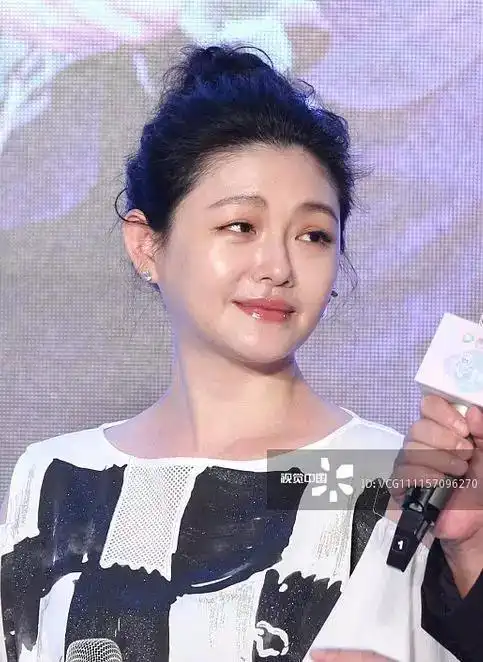 笑起来倒八字眉毛是因为打了肉毒吗,懂技术的小象来说说?