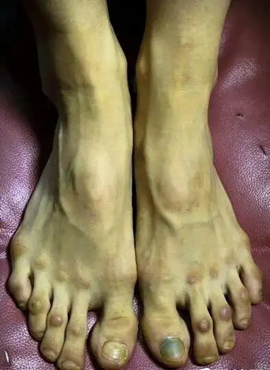 芭蕾舞脚(芭蕾舞脚尖)-生活常识-江湖救急网