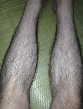 腿毛过多,只能穿长裤,不敢游泳 .有图