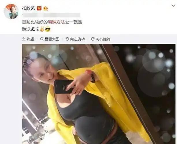 张歆艺孕照曝光大肚子浮肿脸水桶腰却被粉丝盛赞比杨颖真实