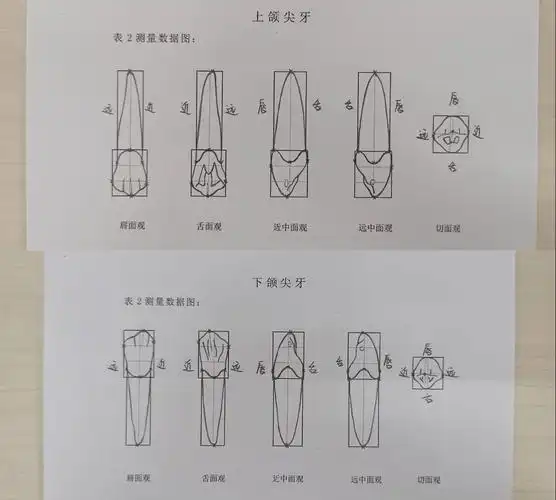 牙体外形绘图