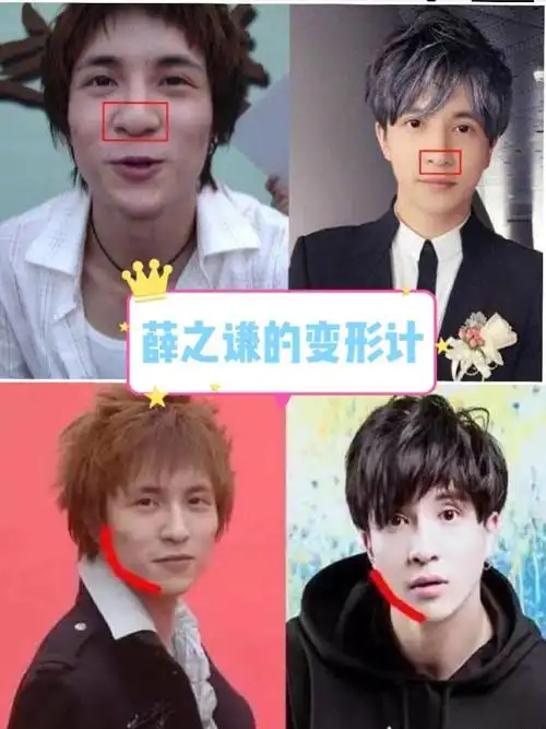 我的爱豆薛之谦变形记