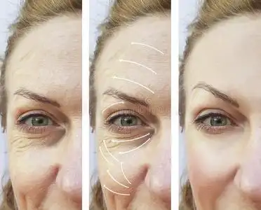 插图在白色背景上化妆前后女性面部的对比肖像化妆前后皮肤有问题的